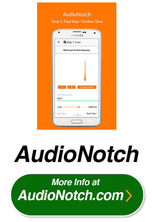 audionotch notched sound therapy for tinnitus